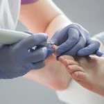img-podologia-preventiva